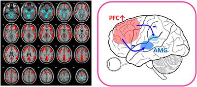 Glutamatergic Dysfunction and Glutamatergic Compounds for Major Psychiatric Disorders: Evidence From Clinical Neuroimaging Studies